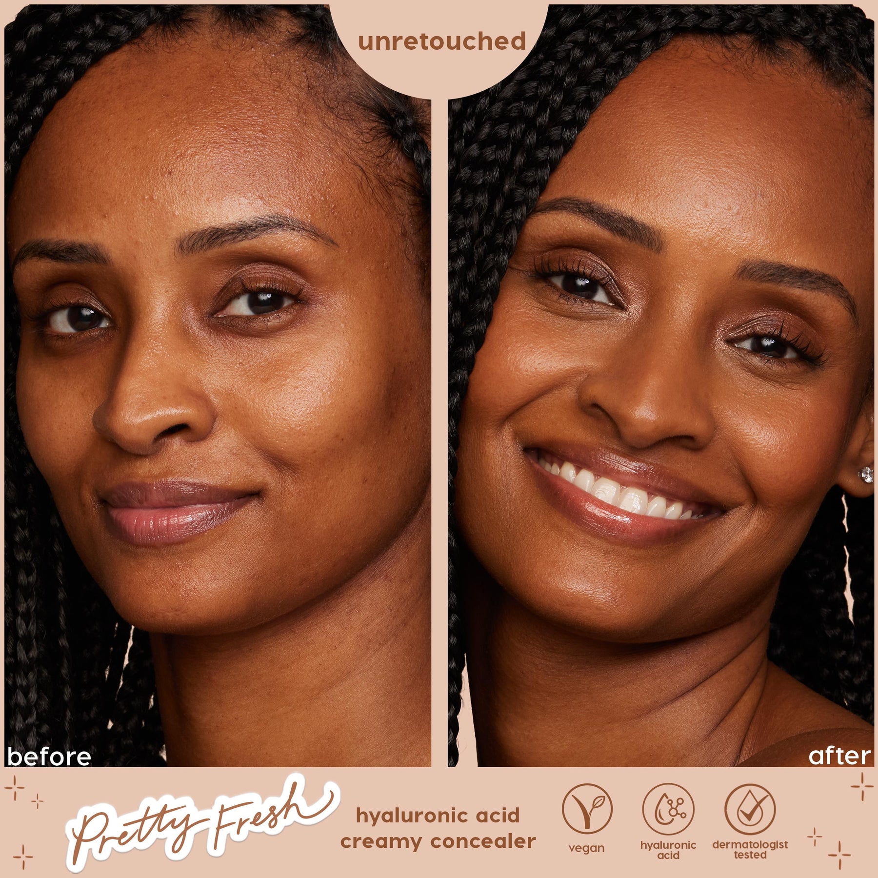 Dark 175 N - Home Choice